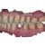 Implant Module