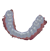 Bite Splint Module