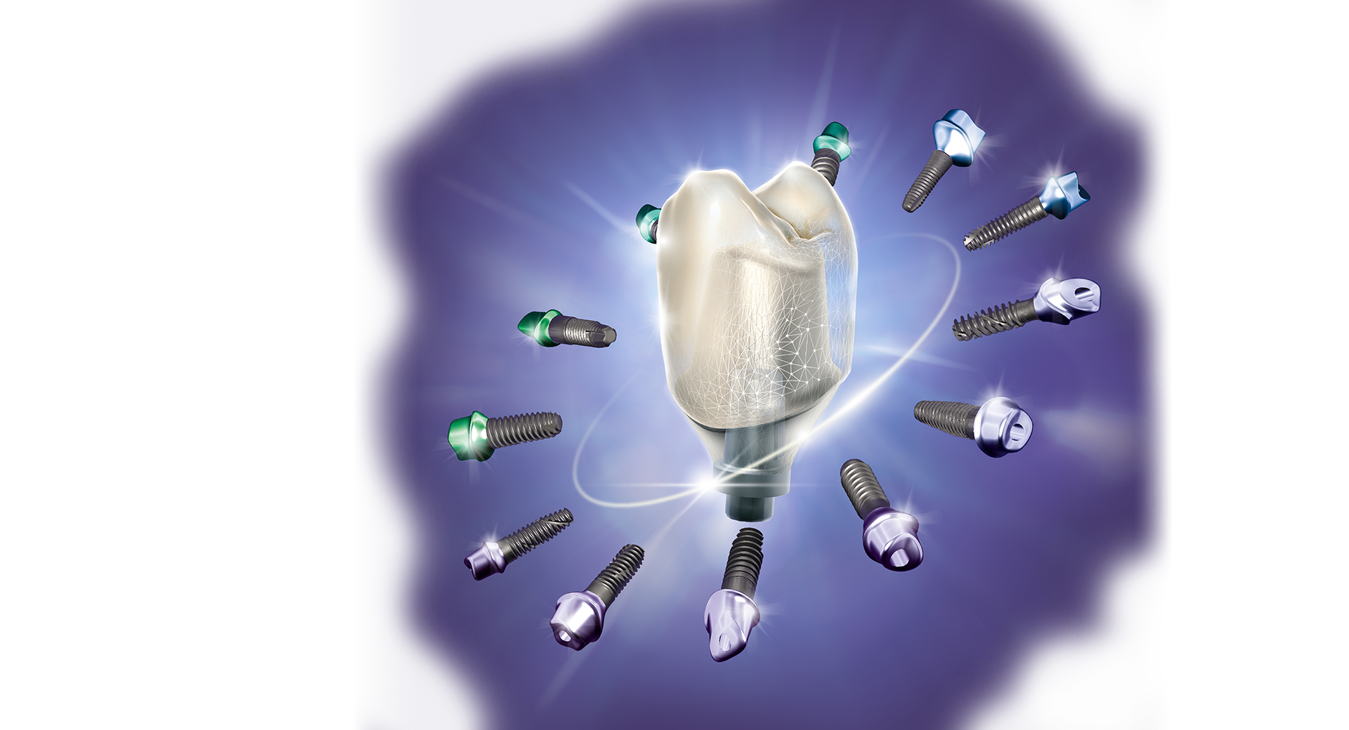 exocad DentalCAD 3.3 Chemnitz