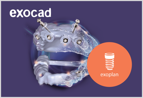 exocad exoplan