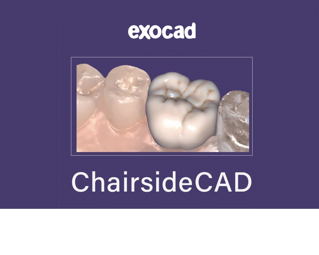 exocad ChairsideCAD