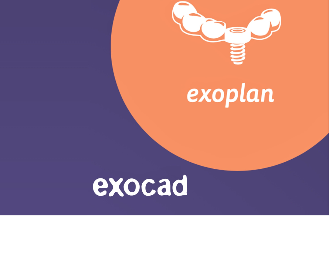 exoplan Implant planning & Guided Surgery