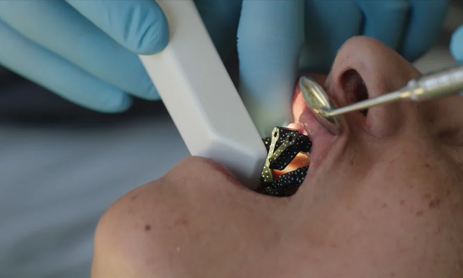 Intraoral photogrammetry scan in a clinical setting