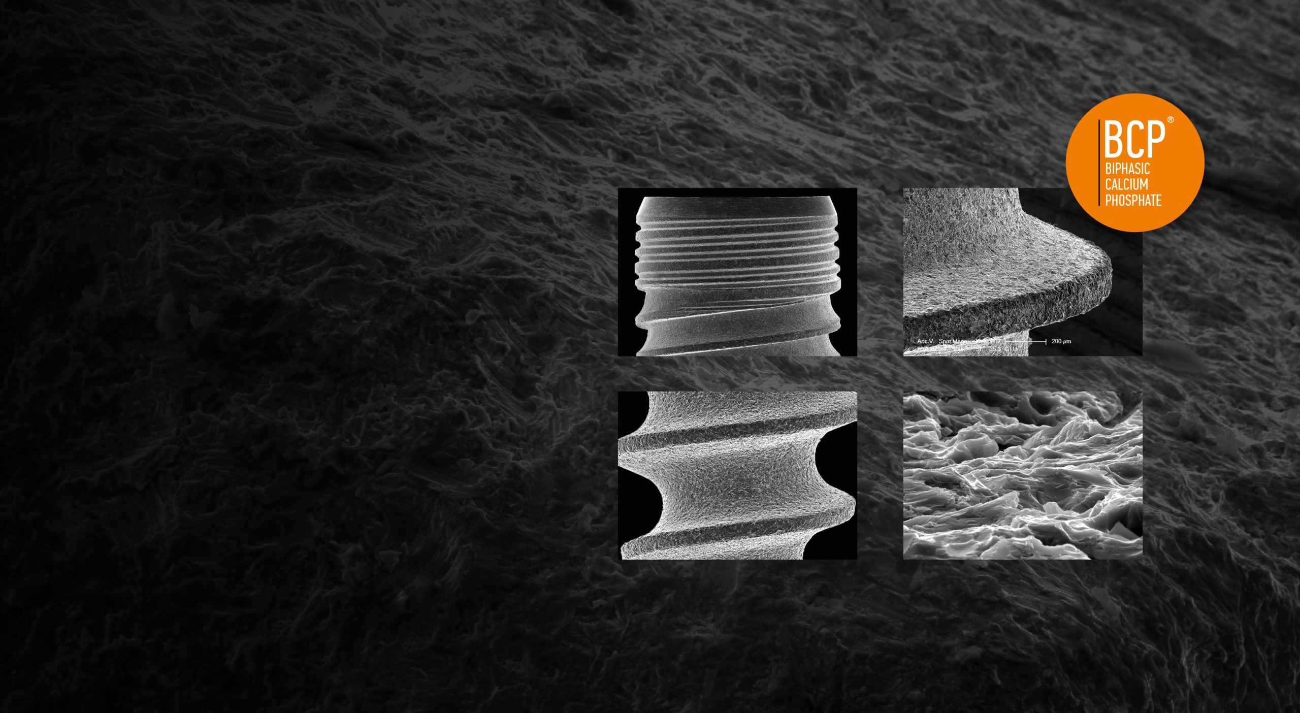 HA Hydroxyapatite OSTEOBLASTIC BCP  SURFACE MORPHOLOGY
