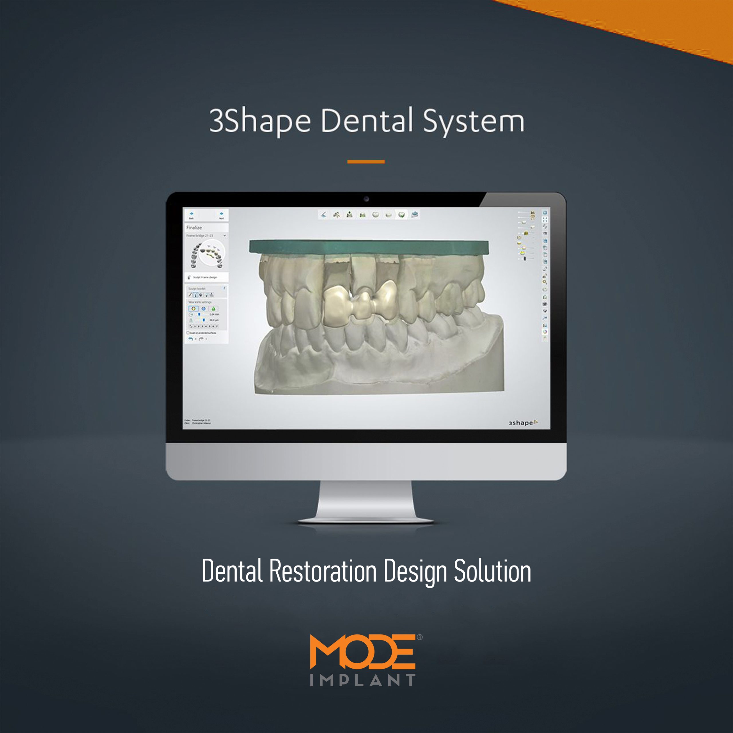3SHAPE Dental System CAD Libraries